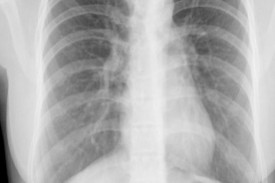 southerncrossxray.jpg